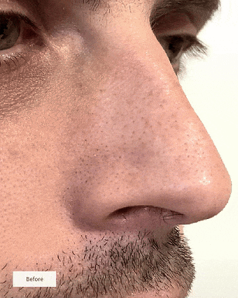 AQA™ Pore Clarifying Salicylic Acid Nose Strips