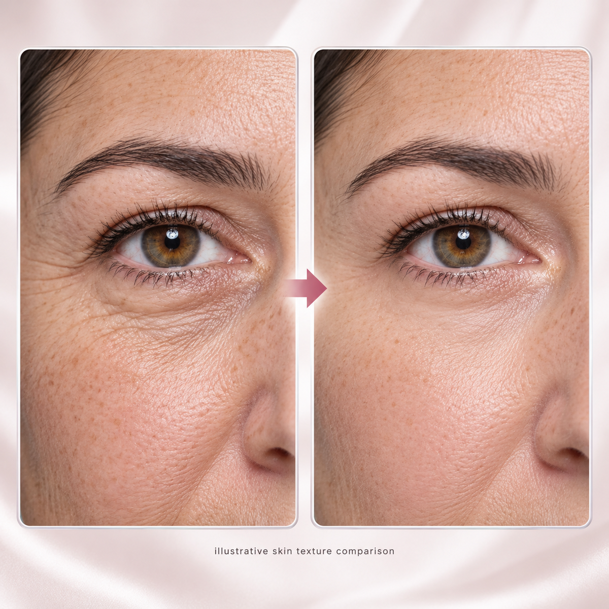 Eye Renewal Creme lifestyle